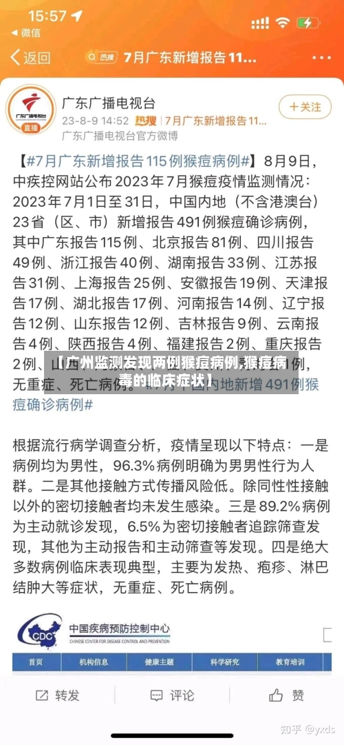 【广州监测发现两例猴痘病例,猴痘病毒的临床症状】