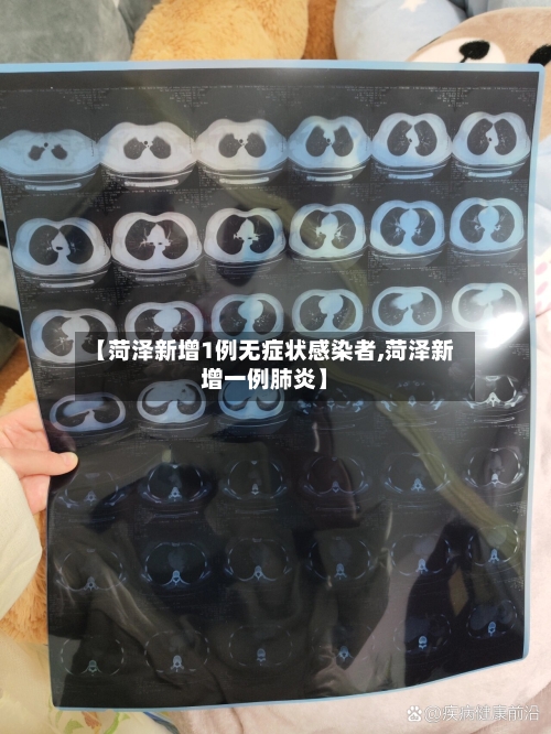 【菏泽新增1例无症状感染者,菏泽新增一例肺炎】-第2张图片